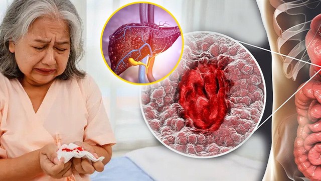 Reasons Of Blood Vomiting:खून की उल्टी आने का क्या कारण है,Khoon Ki Ulti Hone Se Kya Bimari Hoti Hai