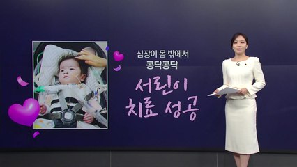 몸 바깥에서 심장 뛰던 '서린이', 국내 첫 수술 성공..."절망 속 희망 준 의료진께 감사" [앵커리포트] / YTN