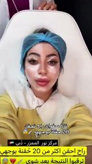 تالا صفوان تتعرض لتشوّه في الوجه بعد حقن إبرة