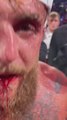 Anthony Joshua’s Brutal KO of Jake Paul: Broken Jaw and a Destroyed Face