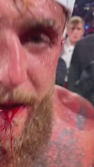 Anthony Joshua’s Brutal KO of Jake Paul: Broken Jaw and a Destroyed Face