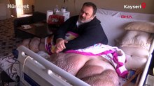 5 yıldır evden çıkamayan 300 kiloya ulaşan fil hastasının hayali; eşiyle kol kola caddede gezmek