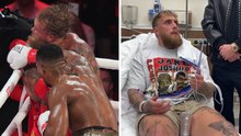 Joshua manda ko e all'ospedale Jake Paul: mascella rotta