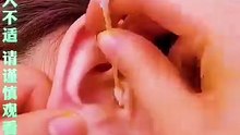 Stop using the old-fashioned ear picks. Replace them with this one