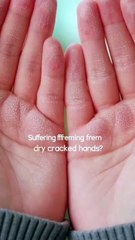 Centella Asiatica Hand Cream Travel Size | Dry Cracked Hands Relief