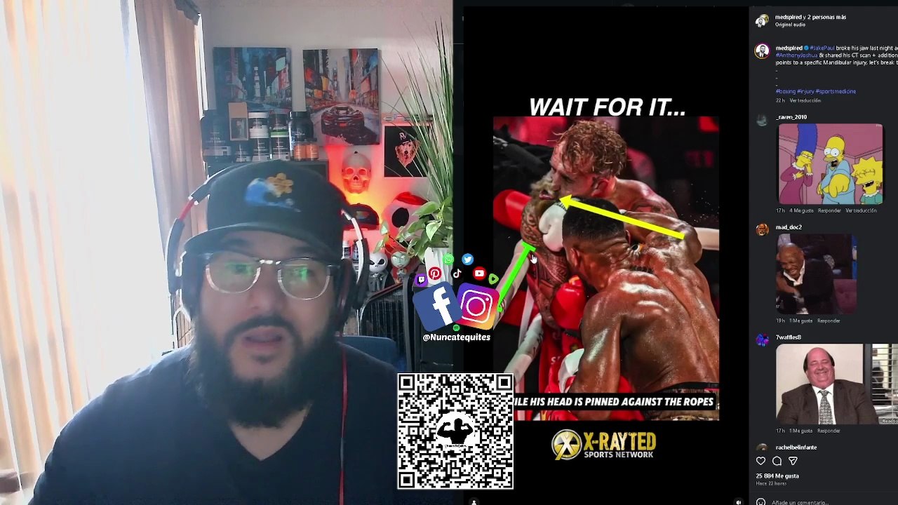 QUE LE PASO A LA MANDIBULA DE JAKE PAUL