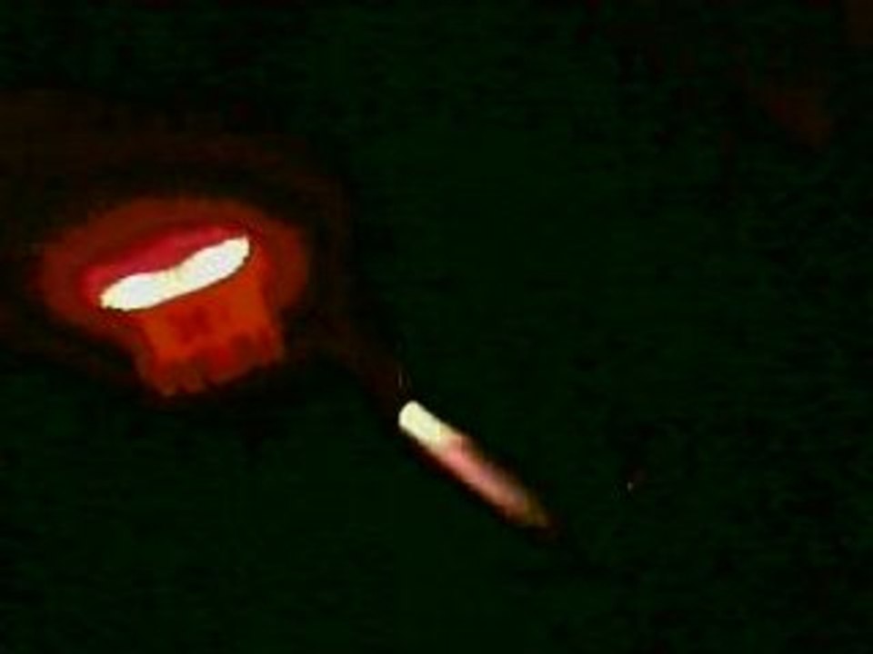 sv rupture