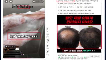 "탈모 예방·억제 효과" 온라인 부당광고 적발 / YTN