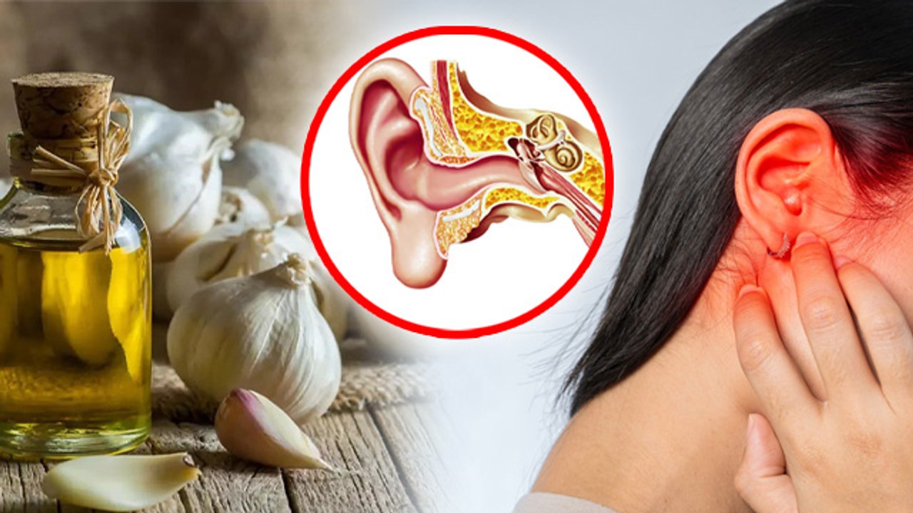 Garlic Oil For Ear:लहसुन का तेल कान में डालने के फायदे,How To Use ...