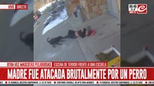 Madre fue atacada brutalmente por un perro y debió ser internada