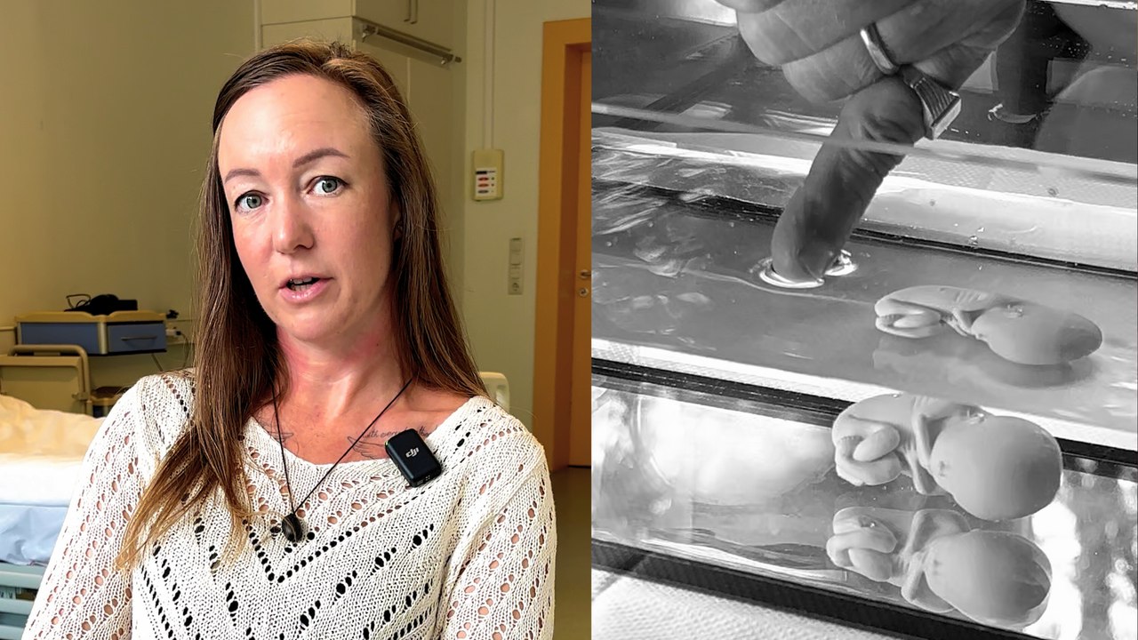 Sternenkinder: Claudia hat ihren toten Sohn fotografieren lassen