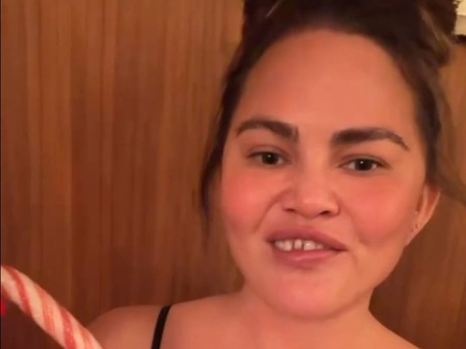 Chrissy Teigen verliert einen Zahn bei Weihnachtsmagie