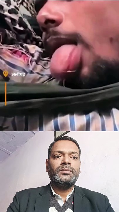Aligarh dog bite ।