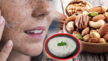 Blemishes On Face: चेहरे की झाइयां कैसे ठीक करें |Chehre Ki Jhaiya Hatane Ke Liye Kya Khana Chahie
