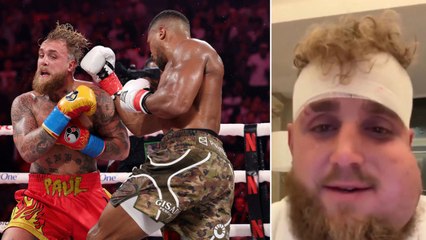 Mandibola fratturata e testa fasciata: Jake Paul si mostra dopo la sfida con Anthony Joshua