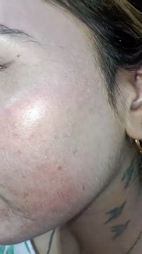 Face facial #facefacial #facialtreatment #facialmask #facials #youtubeshorts #bridelmakup #trending