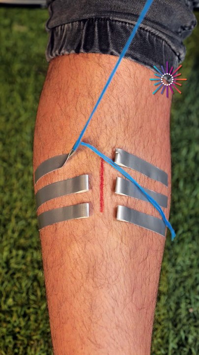 How to patch wounds in urgent situations