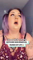 I was quoted $20,000 to fix my botched surgery 😱