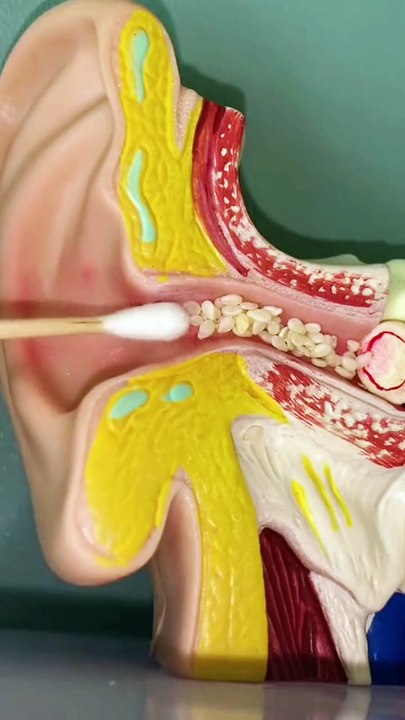 Your ears can be cleaned like this
