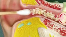 Your ears can be cleaned like this