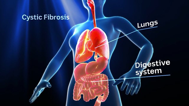 20 years since Australian-first medical procedure that saved two lives