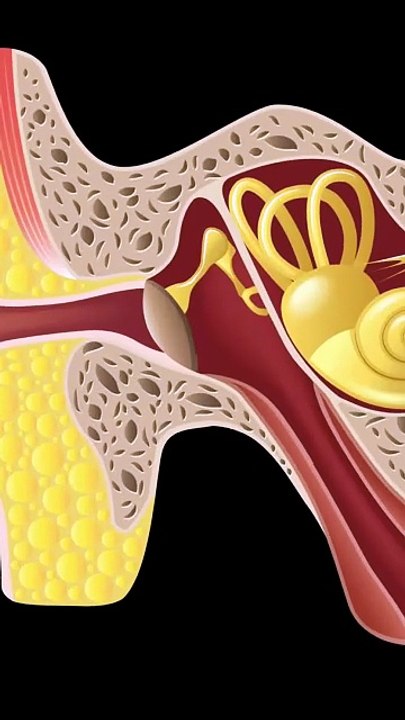 Drainage of Fluid of Middla ear