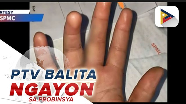 SPMC, iginiit na firecracker-related injury nangyari sa bata noong Dec. 25, 2025 taliwas sa pahayag ng DCPO