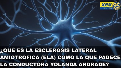 ¿Qué es la esclerosis lateral amiotrófica (ELA) como la que padece la conductora Yolanda Andrade?