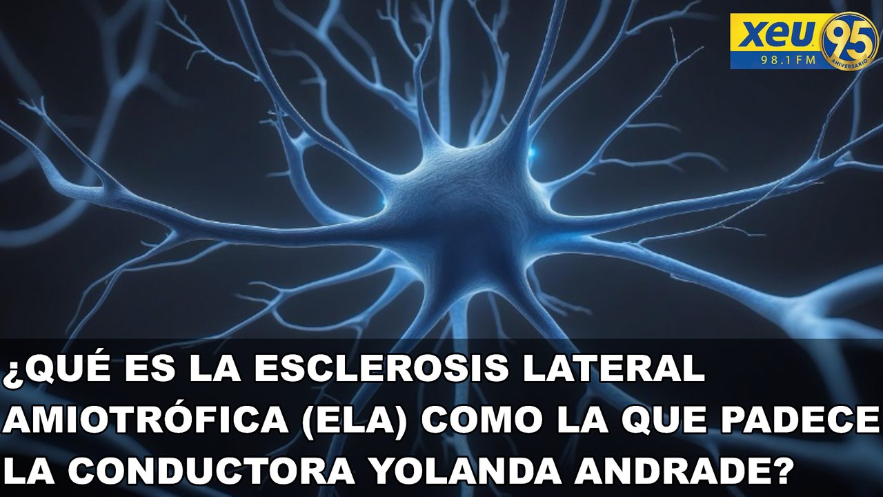 ¿Qué es la esclerosis lateral amiotrófica (ELA)...