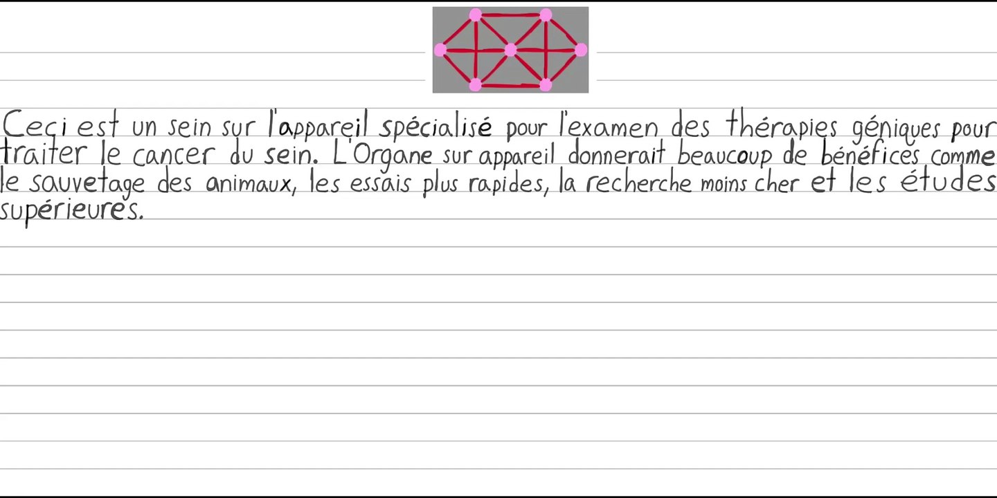 Organe sur puce pour tester les thérapies géniques pour traiter le cancer du sein