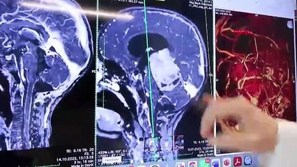 Davranışlarındaki değişim tedirgin etmişti... Minik çocuğun beyninden çıkan şey şoke etti!