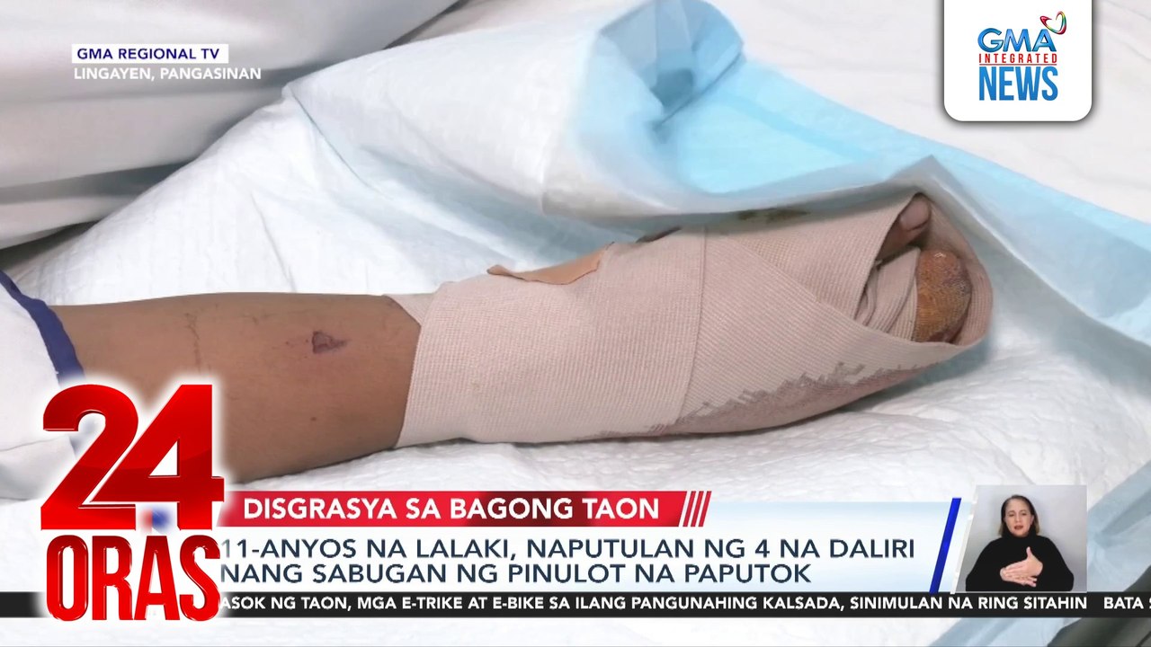11-anyos na lalaki, naputulan ng 4 na daliri nang sabugan ng pinulot na paputok | 24 Oras
