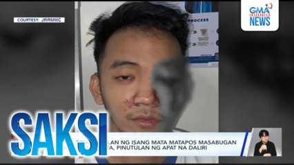 Lalaki, tinanggalan ng isang mata matapos masabugan ng paputok; 2 bata, pinutulan ng apat na daliri | Saksi