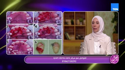 إزاي تختاروا عيادة آمنة، وإيه العوامل اللي لازم تتبعوها لاختيار عيادة أسنان مناسبة لطفلك