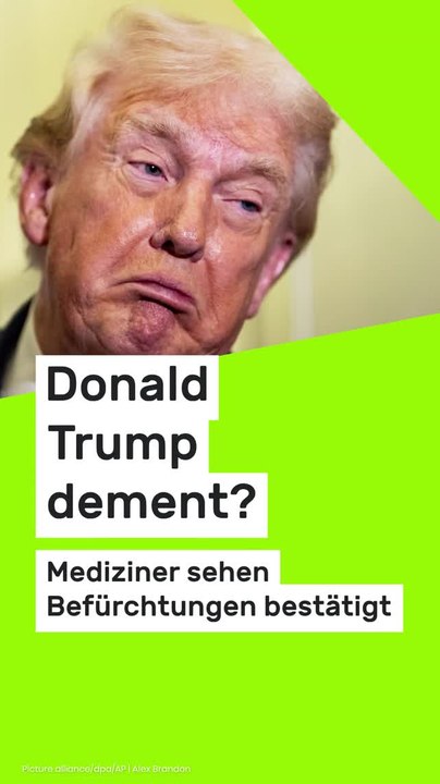 No Glomex Donald Trump dement?: 'The Don' verplappert sich - Mediziner sehen Befürchtungen bestätigt