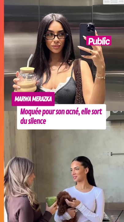 « Ne me jugez pas » : Marwa Merazka moquée pour son acné, elle sort du silence