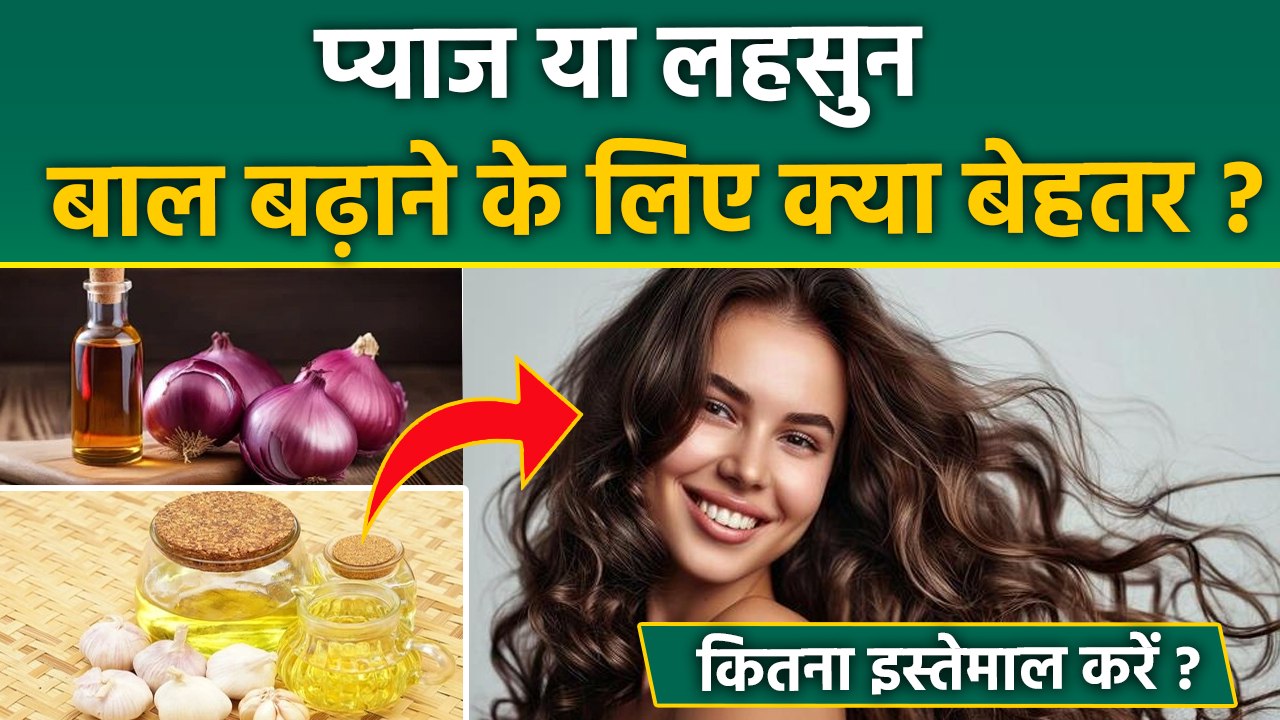 Onion Vs Garlic For Hair Growth : प्याज या लहसुन,बाल बढ़ाने के लिए कौन ज्यादा बेस्ट? Boldsky