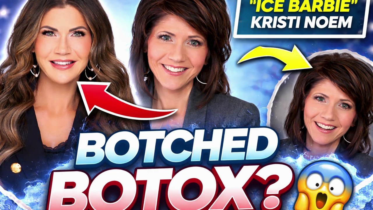 ‘ICE Barbie’ Kristi Noem Urged to ‘Hit the Brakes on the Botox’ After Drastic Look Change