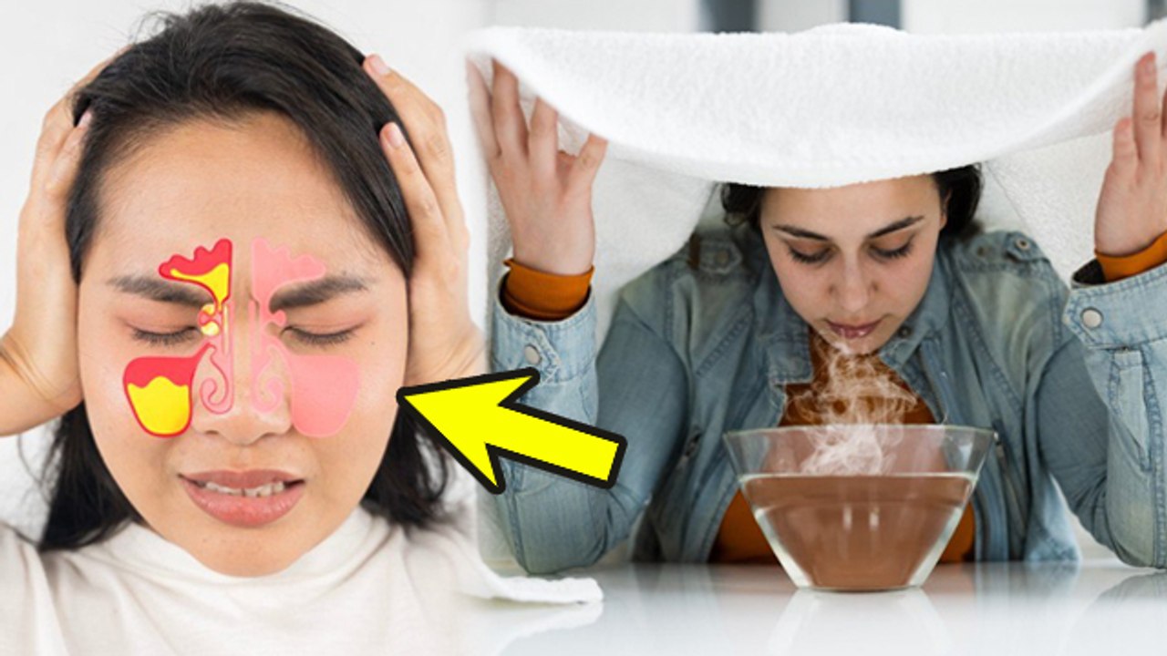 Sinus Treatment Home Tips: साइनस का इलाज,लक्षण और उपचार | Sardi Me Sinus Ka Ilaj |Boldsky