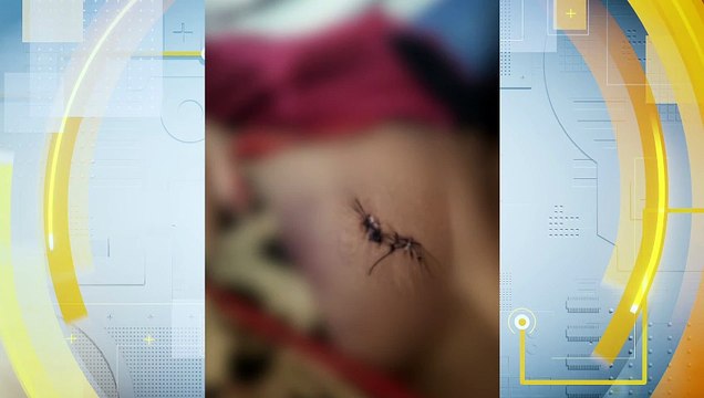Tentativa de Feminicídio em Moreno: Investigação em Andamento após Ex-Companheiro Esfaquear Mulher em Evento Público