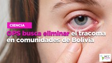 OPS busca eliminar el tracoma en comunidades de Bolivia