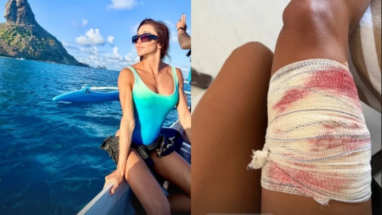 Advogada de SP é mordida por tubarão durante mergulho em Fernando de Noronha