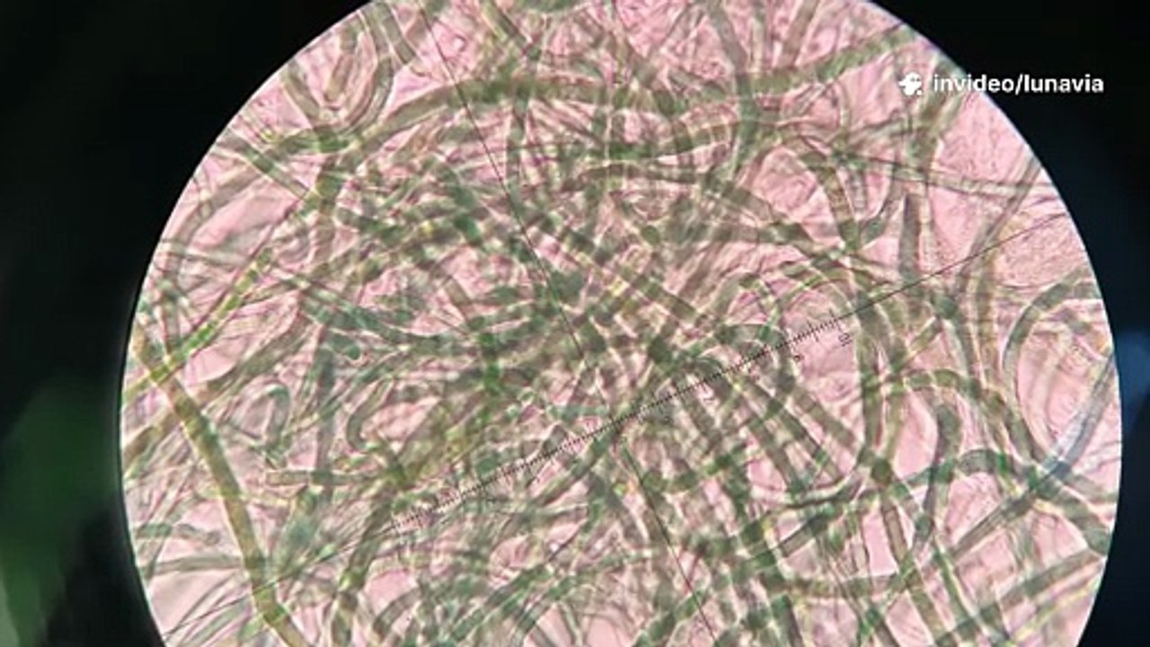 Lunavia AntiFungal Pen:- Lunavia AntiFungal Pen Reviews, Lunavia Nail Pen Reviews!! Lunavia Fungus Pen