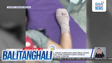 Batang babae, naputulan ng kamay matapos masabugan ng dart bomb | Balitanghali