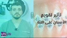 تأثير تقويم الأسنان على اللثة