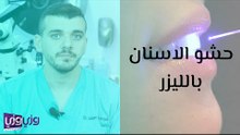 حشو الاسنان بالليزر