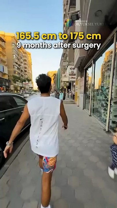 Walking 9 Months After Limb Lengthening Surgery | +9.5 cm Height Increase