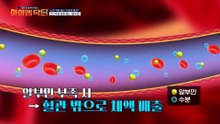 만능 청소부 알부민! 혈관 건강까지 도움을 준다? 노폐물과 독소 배출은 '알부민'에게 맡겨라!
