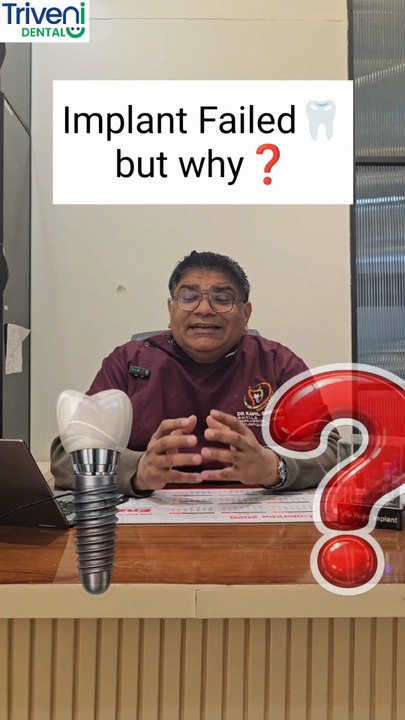 Causes of Dental Implants Failure | Dental Implant Failure | Triveni Dental