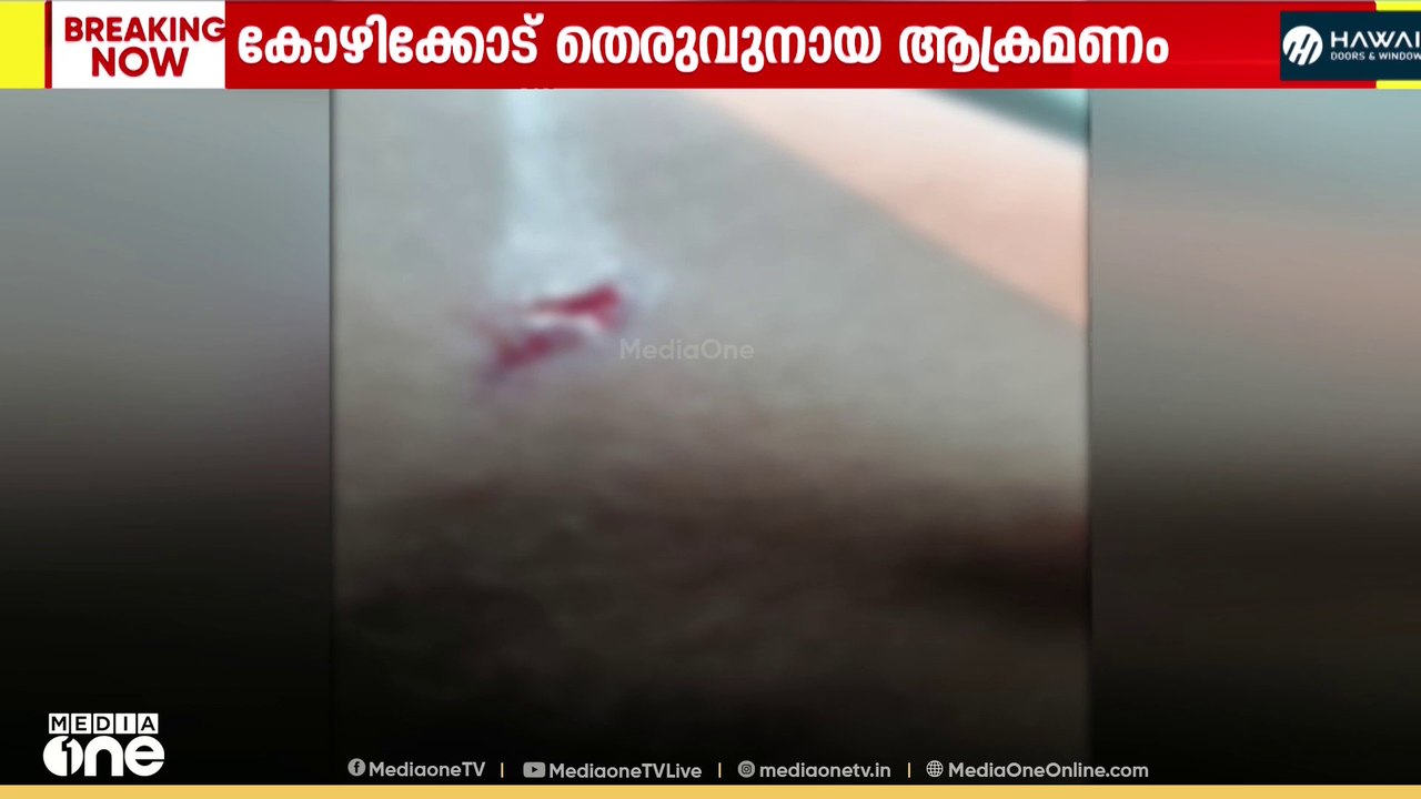 കോഴിക്കോട് അരീക്കാട് വിദ്യാർഥിക്ക് നേരെ തെരുവുന...